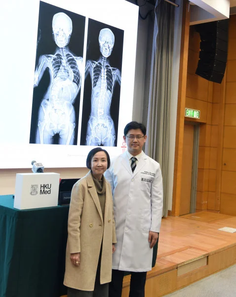 HKUMed research team discovers that genetic factors play a significant role in the development of AIS, paving the way for the future development of new diagnostic methods and potential preventive therapies. (Photo: Professor Jason Cheung Pui-yin and AIS patient Miss Law)  